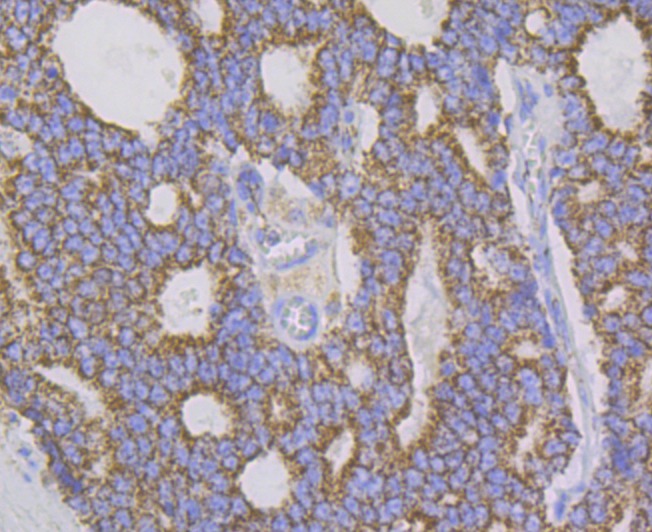 Anti-Aconitase 2 Antibody (9R777)