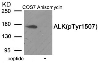 Anti-Phospho-ALK (Tyr1507) Polyclonal Antibody