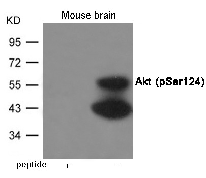 Anti-Phospho-AKT1 (Ser124) Polyclonal Antibody