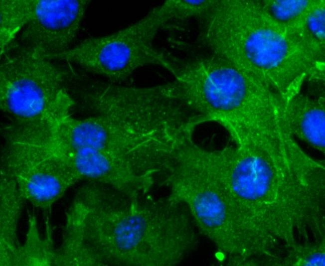 Anti-ACTA1 Antibody (8R189)
