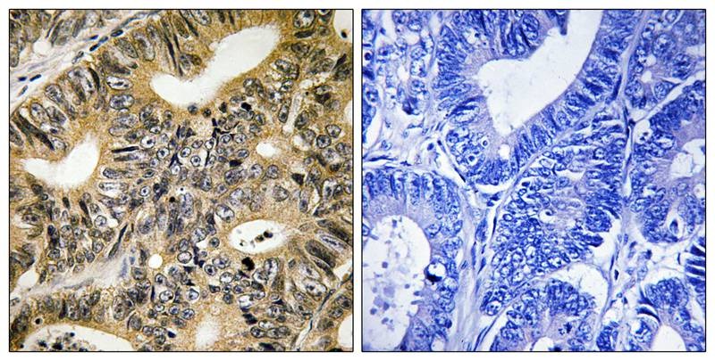 Anti-Phospho-4EBP1 (Thr70) Polyclonal Antibody