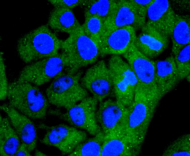 Anti-ACSS2  Antibody (3X184)