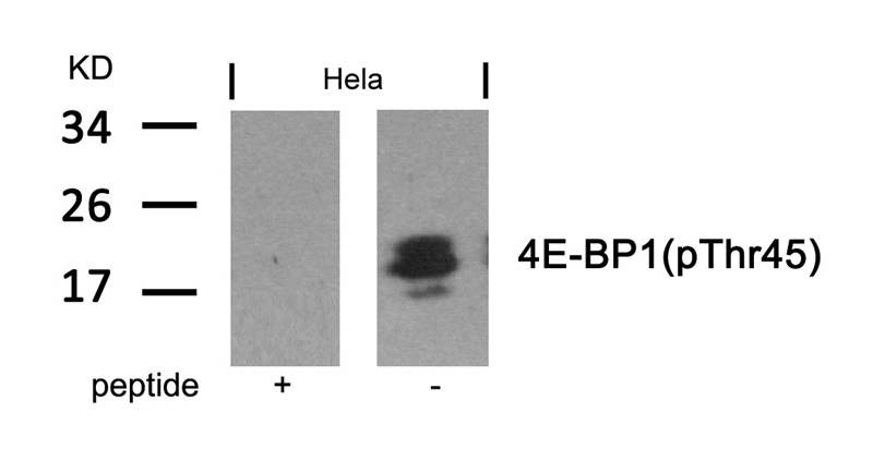 Anti-Phospho-4EBP1 (Thr46) Polyclonal Antibody