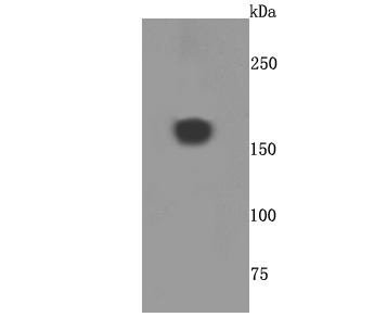 Anti-Alpha-2-macroglobulin Antibody (9L785)