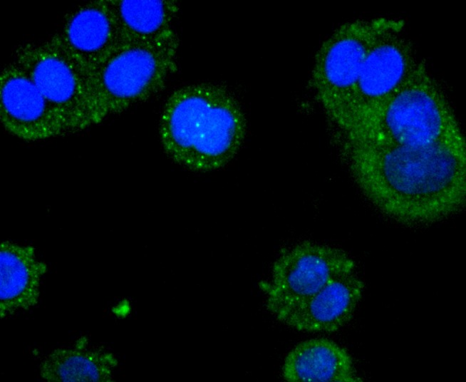 Anti-ACSS2  Antibody (3X184)
