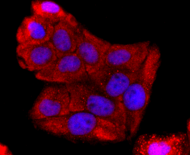 Anti-ABCG2 Antibody (4D379)