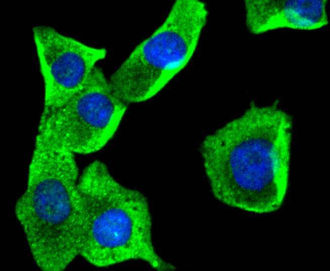 Anti-AKAP14 Antibody (9H736)