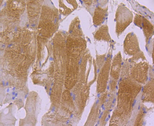 Anti-ACTA1 Antibody (8R189)