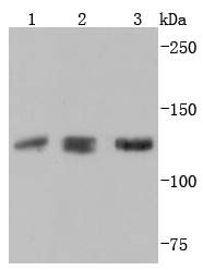 Anti-ABL2 Antibody (4X240)