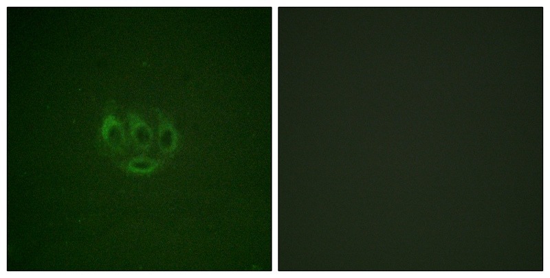 Anti-Phospho-ACK1 (Tyr284) Polyclonal Antibody