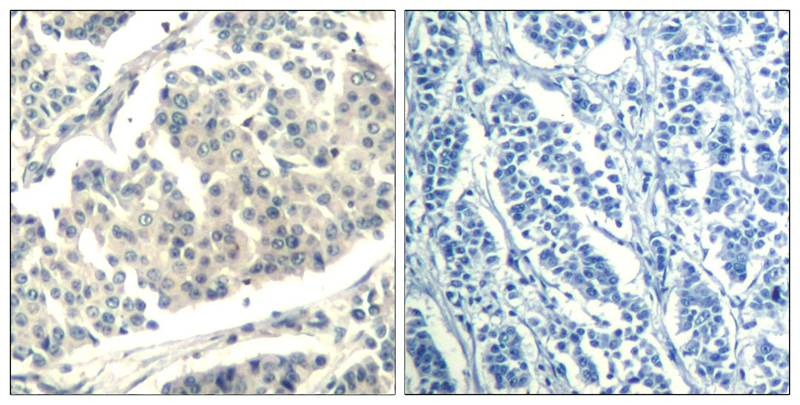 Anti-Phospho-C-ABL1/2 (Tyr393/439) Polyclonal Antibody