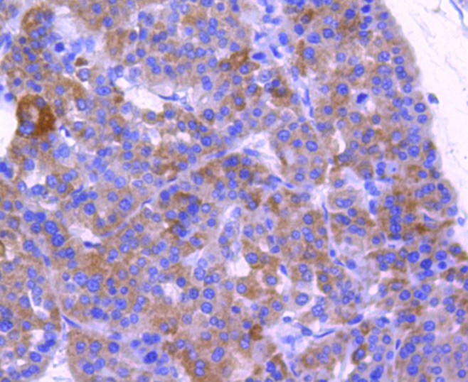 Anti-ABCF1 Antibody (8X278)