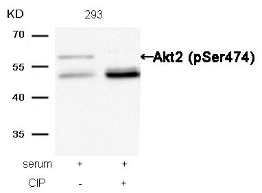 Anti-Phospho-AKT2 (Ser474) Polyclonal Antibody