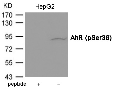 Anti-Phospho-AHR (Ser36) Polyclonal Antibody 2