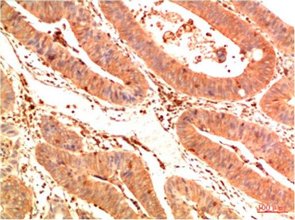 Anti-Acetyl-P53 (Lys382) Antibody (4U766)