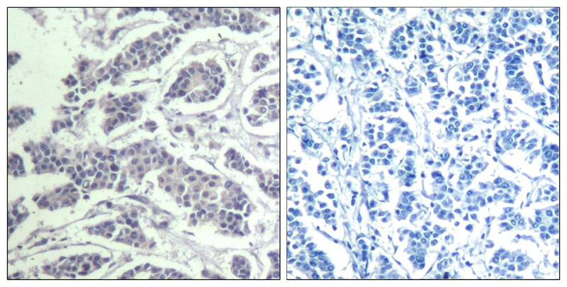 Anti-Phospho-AKT1/2/3 (Tyr315/316/312) Polyclonal Antibody