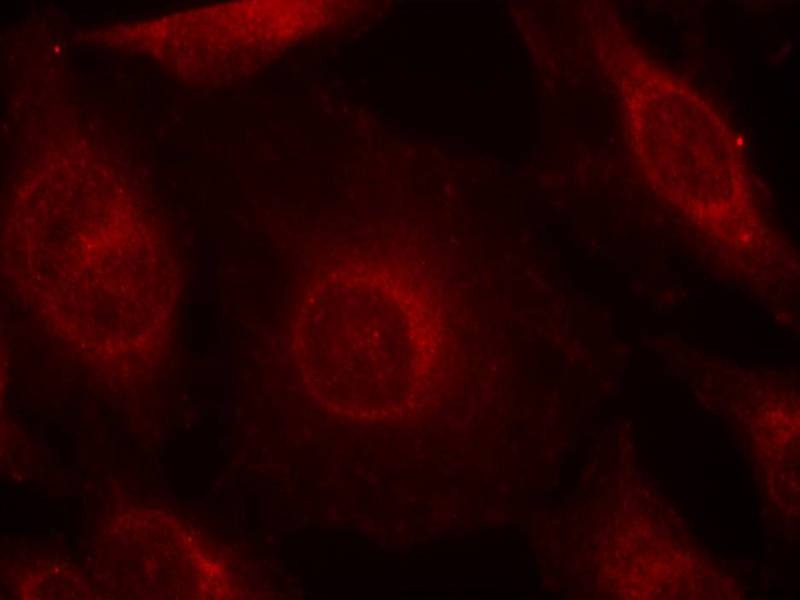 Anti-Phospho-AKT1/2/3 (Tyr315/316/312) Polyclonal Antibody