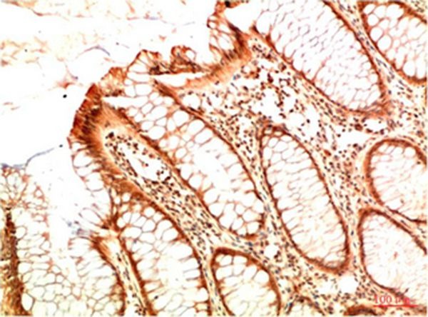 Anti-Acetyl-P53 (Lys382) Antibody (4Z92)