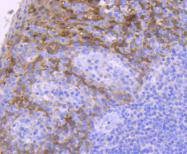 Anti-14-3-3 sigma Antibody (2I538)