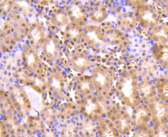 Anti-AKT1/2/3 Antibody (8U152)