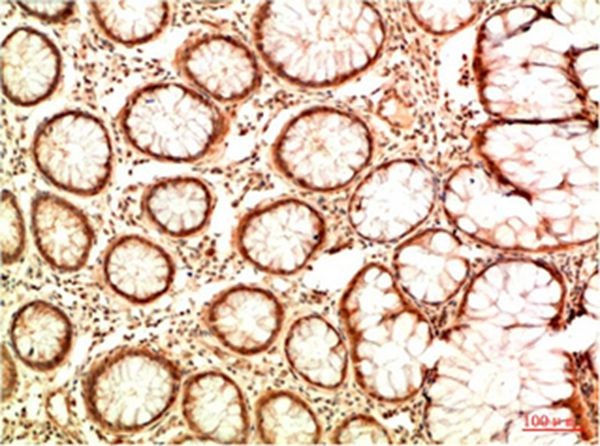 Anti-Acetyl-P53 (Lys382) Antibody (4Z92)