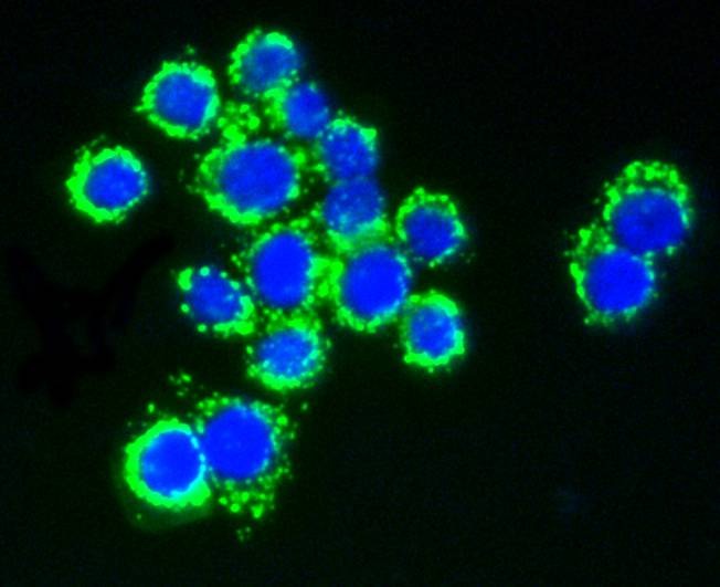 Anti-AKT1/2/3 Antibody (8U152)