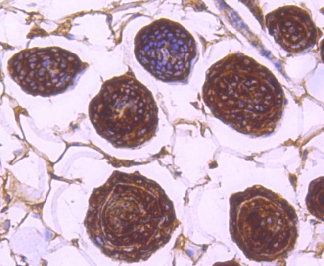 Anti-14-3-3 beta/alpha Antibody (7X437)