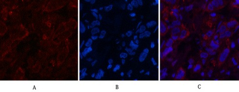 Anti-AFP Antibody (6V105)