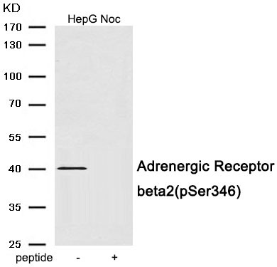 Anti-ADRB2 Polyclonal Antibody 3