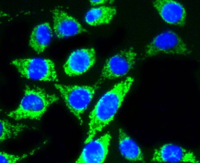 Anti-AKT1/2/3 Antibody (8U152)