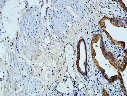 Anti-AFP Antibody (6V105)