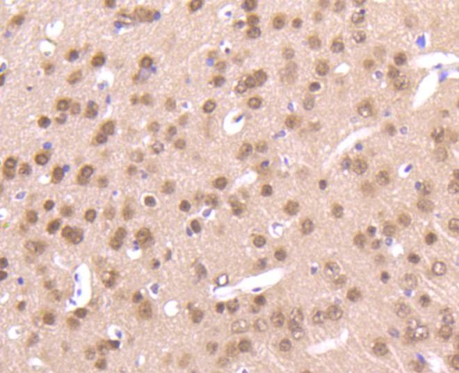 Anti-AKT1/2/3 Antibody (8U152)