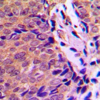 Anti-Phospho-AHR (Ser36) Polyclonal Antibody
