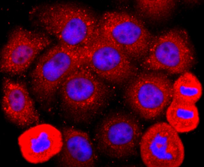 Anti-ADFP Antibody (9D818)