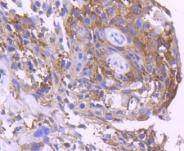 Anti-14-3-3 sigma Antibody (2I538)