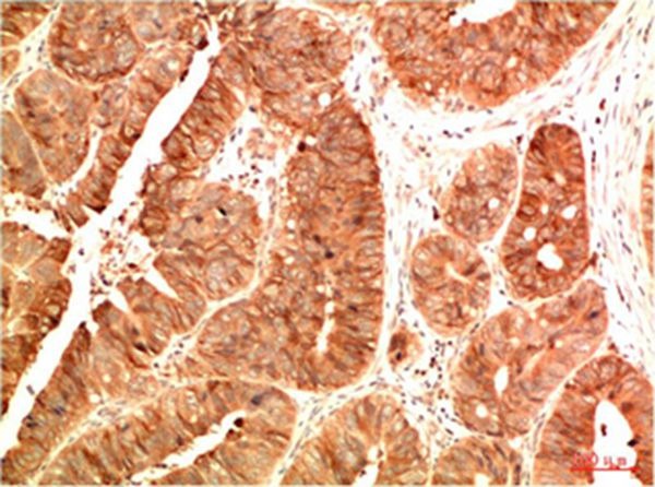 Anti-Acetyl-P53 (Lys382) Antibody (8J875)