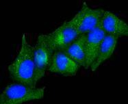 Anti-ADIPOR1 Antibody (2S638)