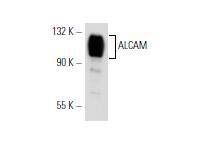 Anti-ALCAM Antibody (9Q637)