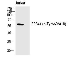 Anti-Phospho-4.1R (Tyr660) Polyclonal Antibody