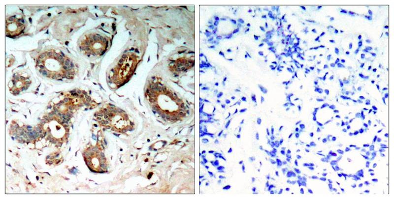 Anti-Phospho-14-3-3 zeta/delta (Ser58) Polyclonal Antibody