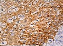 Anti-ALAS2 Antibody (2M567)