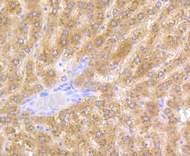 Anti-Alcohol Dehydrogenase Antibody (3W28)