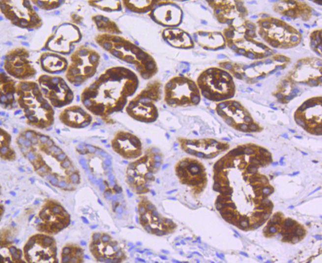 Anti-ALDH1A1 Antibody (5U452)