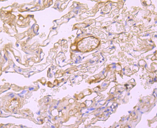 Anti-ALB Antibody (6N642)