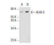 Anti-ALAS2 Antibody (2M567)