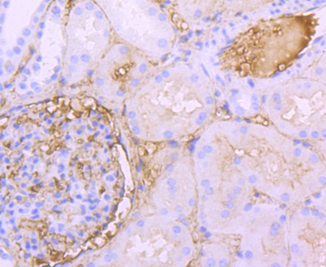 Anti-ALB Antibody (6N642)