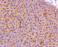 Anti-ADIPOR1 Antibody (2S638)