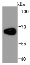 Anti-ALB Antibody (6N642)