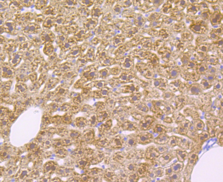 Anti-Alcohol Dehydrogenase Antibody (3W28)