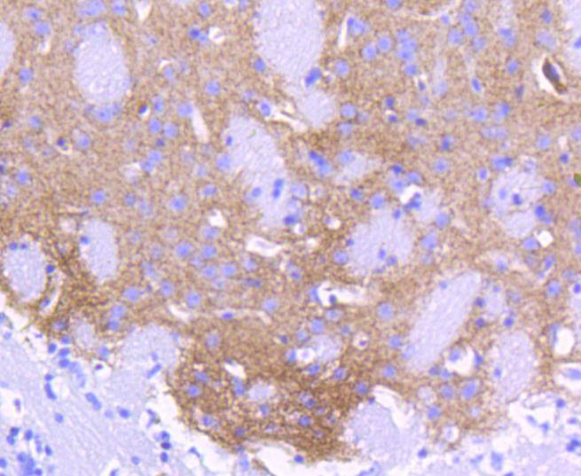 Anti-ALDH1A1 Antibody (5U452)